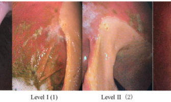 Mavesår hos heste – et skjult problem? Mavesår hos heste – et skjult problem?